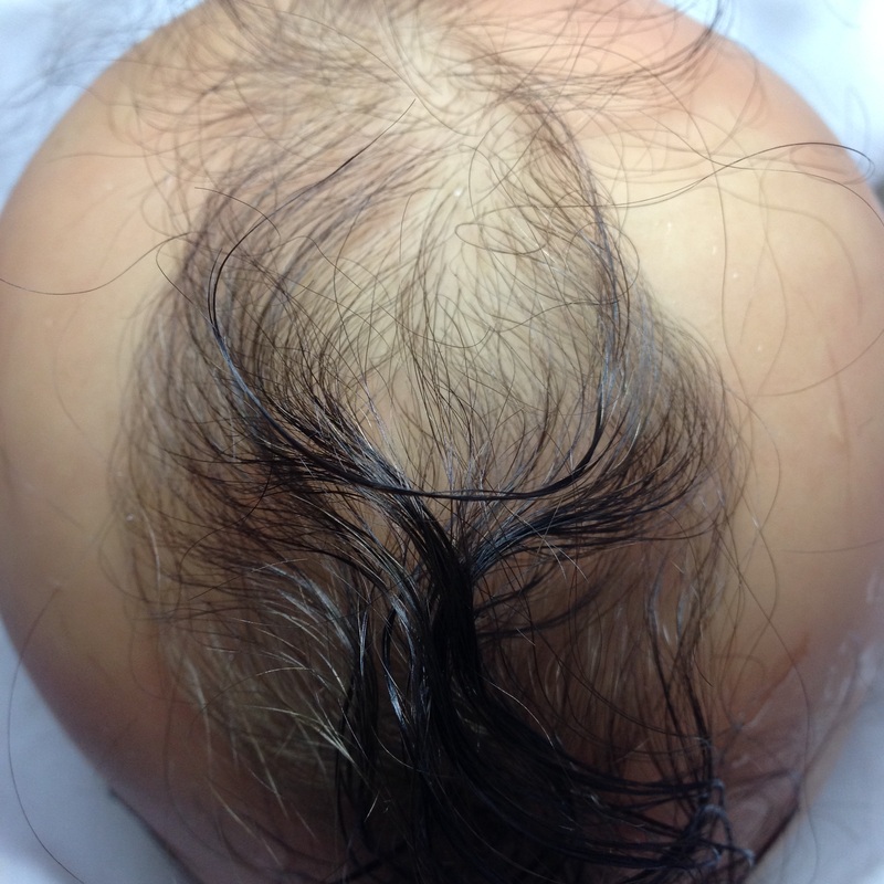 Advice to Cover Bald Spots After Rerooting Doll. : r/DollCustomization